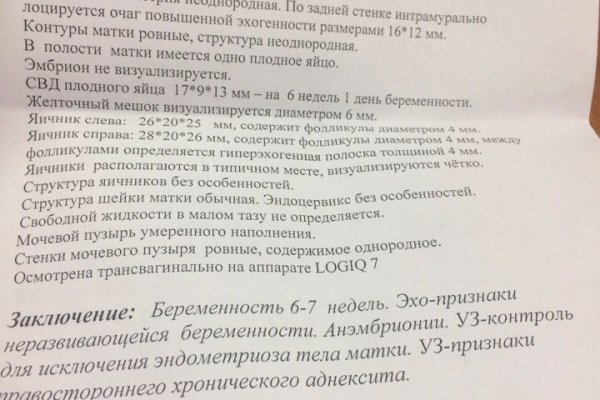 Кракен 2kr pro